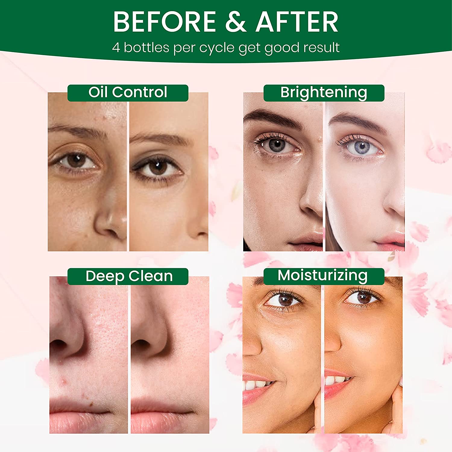 face skin status of before and after using green tea facial mask 80201500 from cuteage